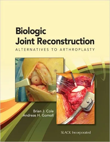 Cover of cartilage repair textbook co-authored by Dr. Gomoll
